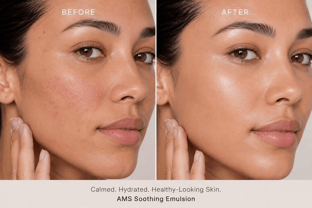 AMS Soothing Emulsion - Hydrating Moisturizer Emulsion - AMS Cosmetics